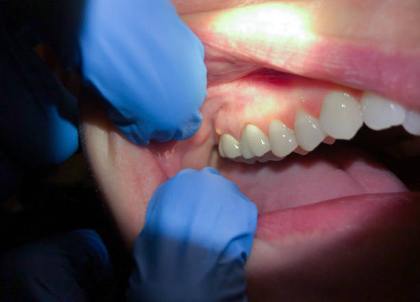 Best Emergency Treatment for Toothache in Borger, TX