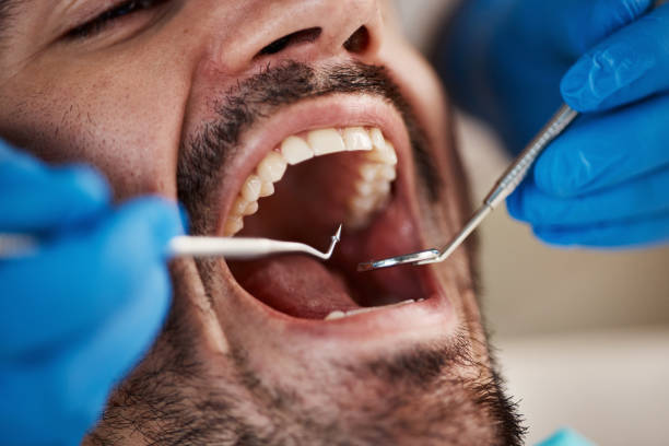 Best Emergency Tooth Extraction in Borger, TX
