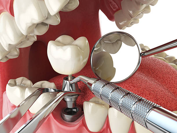 Best After-Hours Emergency Dentist in Borger, TX